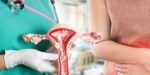uterus